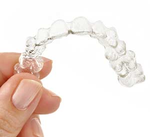 Invisalign Invisible Braces